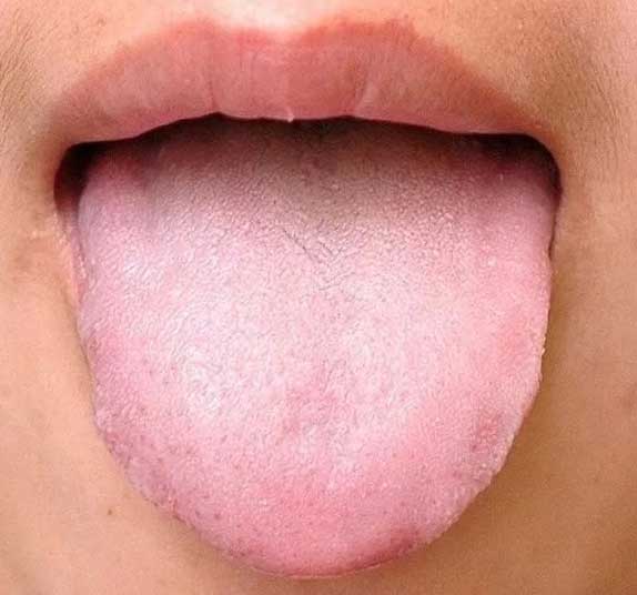 中医舌诊：26个常见高清舌诊图