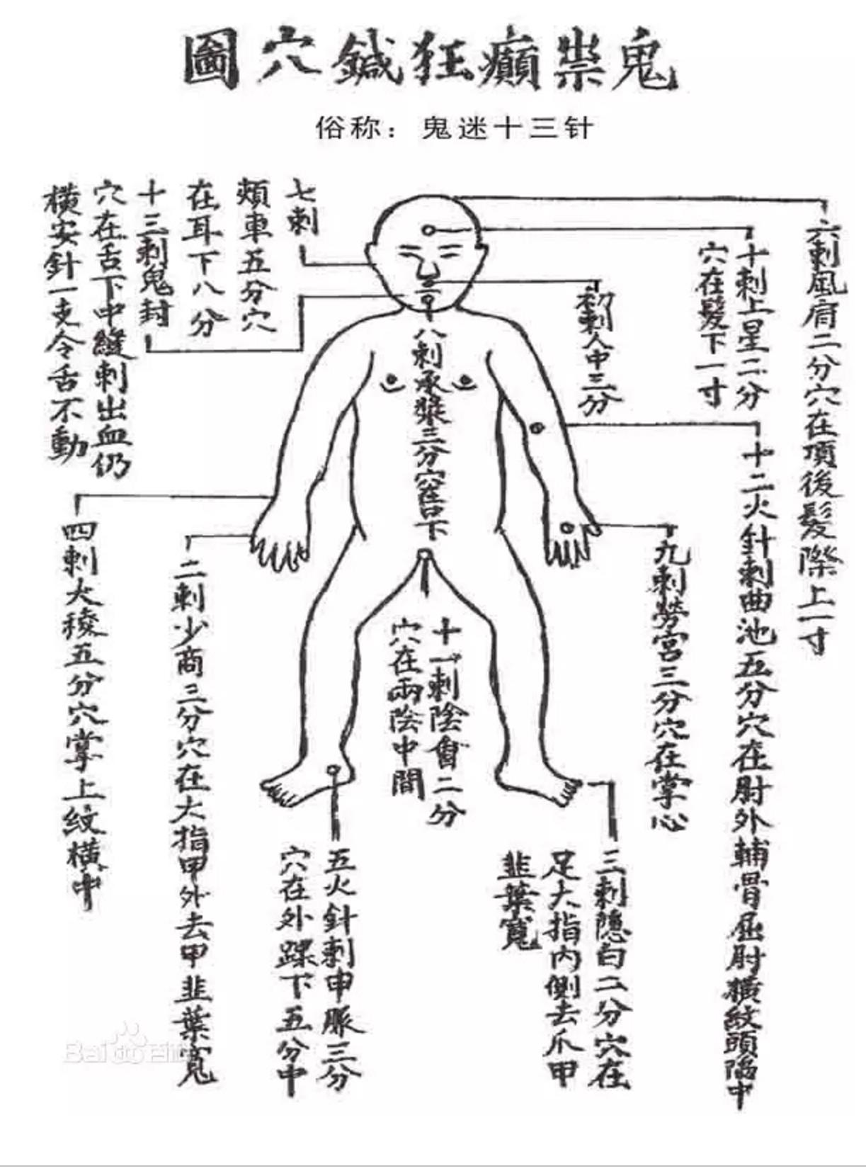 倪海厦鬼门十三针治病案例(图1)