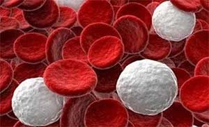 白血病（血癌）的病机病因分类和倪海厦治白血病方法
