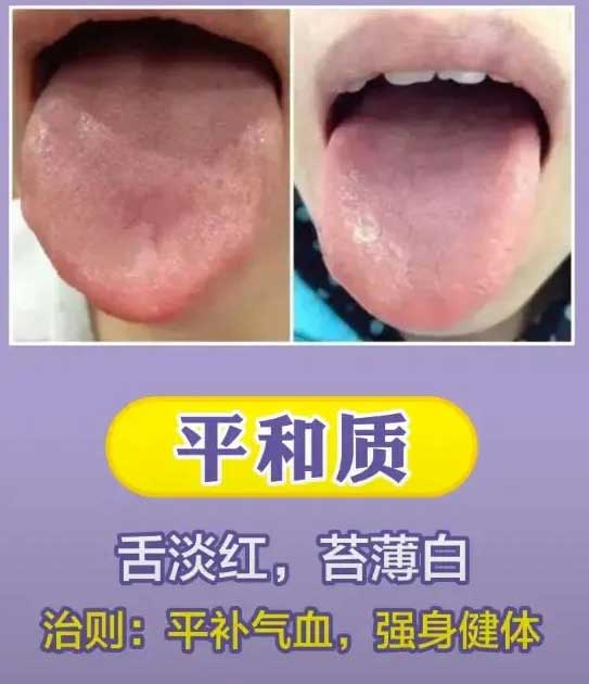 中医舌诊：最常见九大体质舌诊图