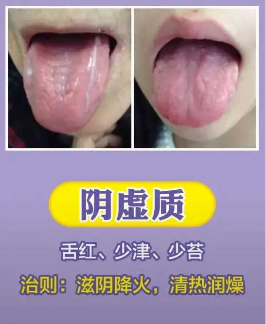 《中医舌诊》最常见九大体质舌诊图(图2)