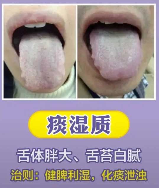 《中医舌诊》最常见九大体质舌诊图(图5)