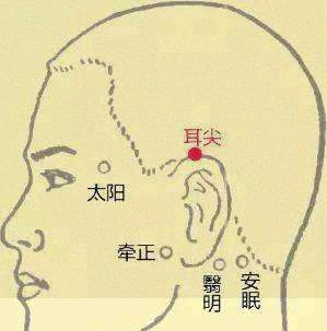 耳尖穴(图1)