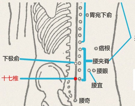 十七椎穴(图1)