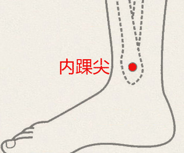 内踝尖穴(图1)