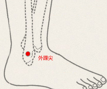 外踝尖穴(图1)