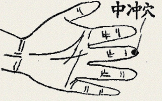 中冲穴(图1)